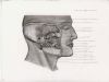 infratemporal region - dissection