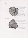 spleen. visceral and costal surface