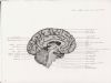 midline saggital section - left half of brain