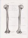 left humerus