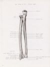 left radius and ulna posterior aspect