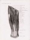 anterior aspect of right thigh