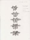 lumbar vertebrae