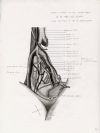 vessels and nerves on the lateral aspect of the right side of the pelvis with the trunk in the rt lateral position