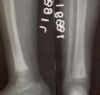 lytic lesion lower end tibia 