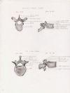 7lb thoracic vertebra