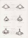 atlas , axis, cervical vertebra